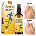 ArtiFix™ Spray Articulaire au Magnésium & Miel | Répare vos articulations et élimine la douleur en 10 minutes !