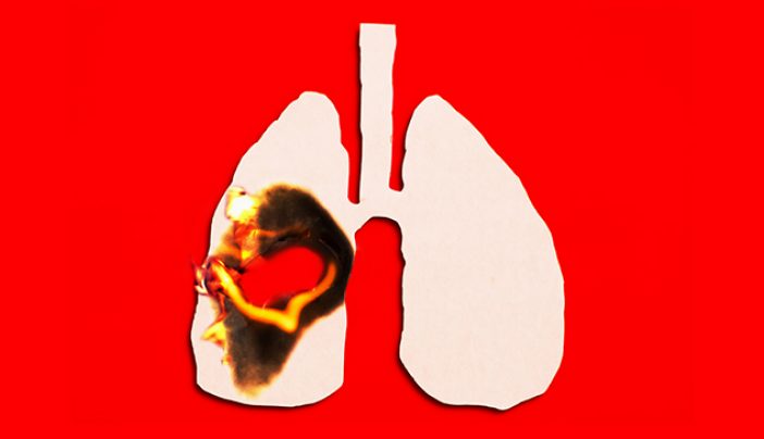 What happens to your lungs from smoking?